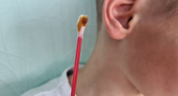 Bouchon de cérumen dans l’oreille