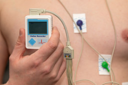 Monitoring cardiaque (surveillance ECG ambulatoire)