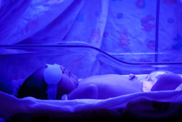 Jaunisse du nouveau-né (ictère néonatal)