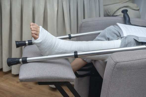 Fracture du tibia ou du péroné