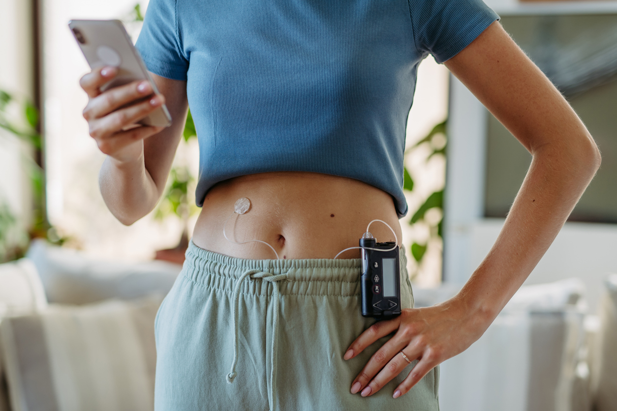 Une personne se tient debout dans une pièce. Elle tient son téléphone portable en main. Il y a une petite pastille collée sur son ventre. Cette pastille est reliée par un fil à un petit appareil accroché à l'élastique de son pantalon.