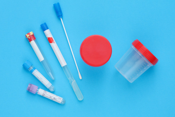 Dépistage des Infections Sexuellement Transmissibles (IST)