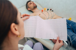 ﻿Électrocardiogramme (ECG) chez l’adulte