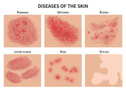 Problèmes et maladies de la peau fréquentes