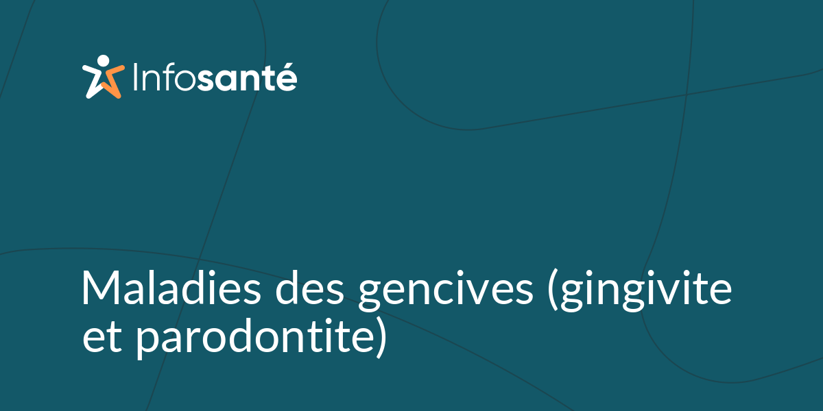 Maladies Des Gencives (gingivite Et Parodontite) • Infosanté